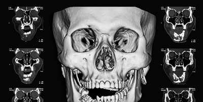 Computed tomography scan showing signs of facial trauma